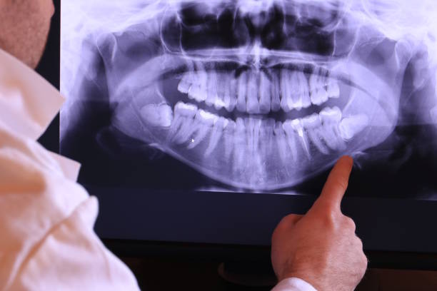 Best Emergency Care for Gum Disease in Argentine, MI