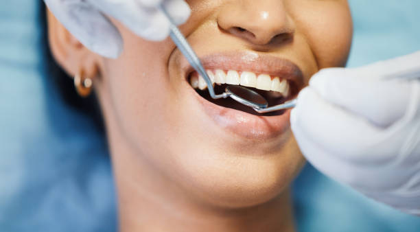 Best Dental Abscess Treatment in Argentine, MI